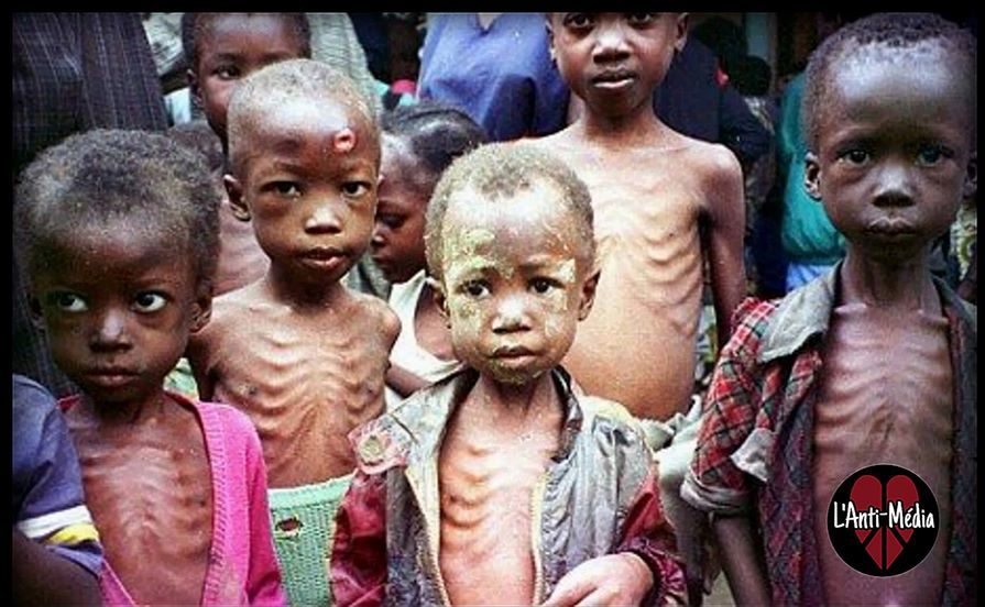 Il virus “malnutrizione” uccide un bambino ogni 10 secondi